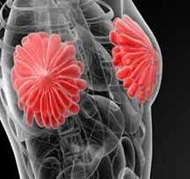 دکتر سرطان پستان و سینه در شهرک ژاندارمری