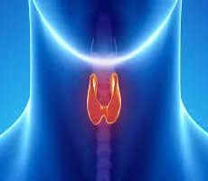 دکتر سرطان تیروئید در آسمانها