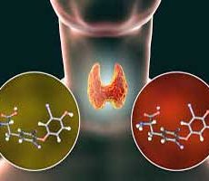 دکتر سرطان تیروئید در فرمانیه