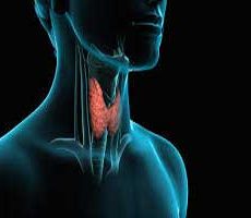 دکتر سرطان تیروئید در قبا
