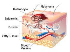 دکتر سرطان پوست در داودیه