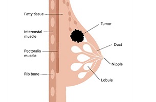 best breast cancer surgeon at sloan kettering