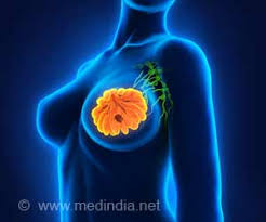 best breast cancer surgeon london