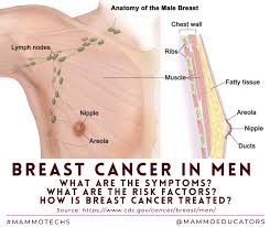 best breast cancer surgeon seattle