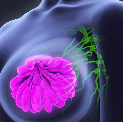 breast cancer oncoplastic surgeon