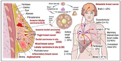 breast cancer surgeon ğv