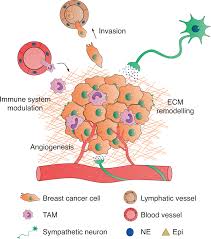 breast cancer surgeon in kolkata