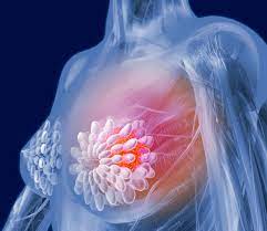 breast cancer surgeon in rawalpindi