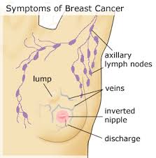 breast cancer surgeon jobs