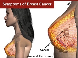 breast cancer surgeons phoenix az