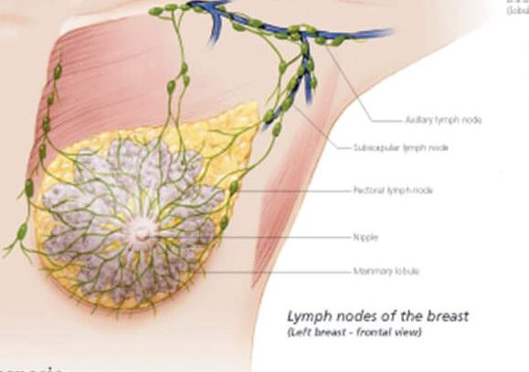 breast cancer surgery types