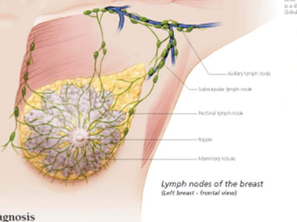 breast cancer surgery types