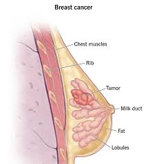 how much does a breast cancer surgeon make