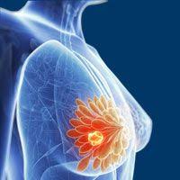 top breast cancer surgeon in chicago